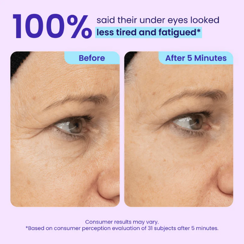 Wellow PureGo™ Instant Eye Lift