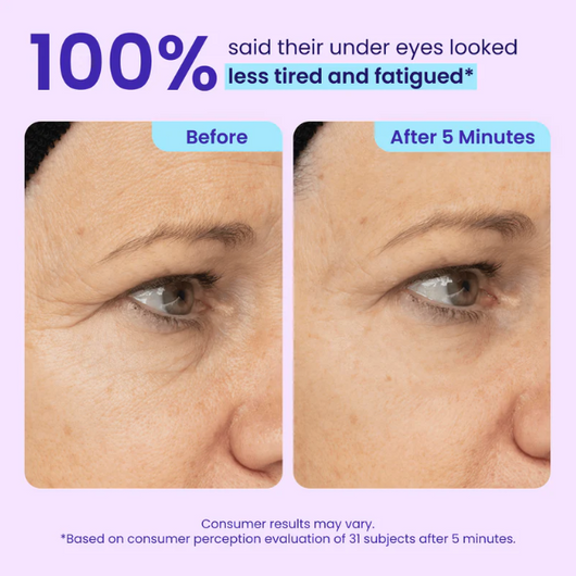 Wellow PureGo™ Instant Eye Lift