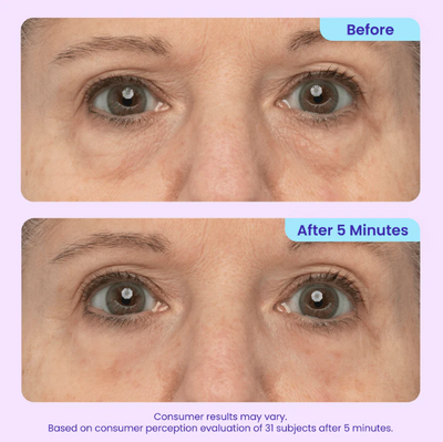Wellow PureGo™ Instant Eye Lift