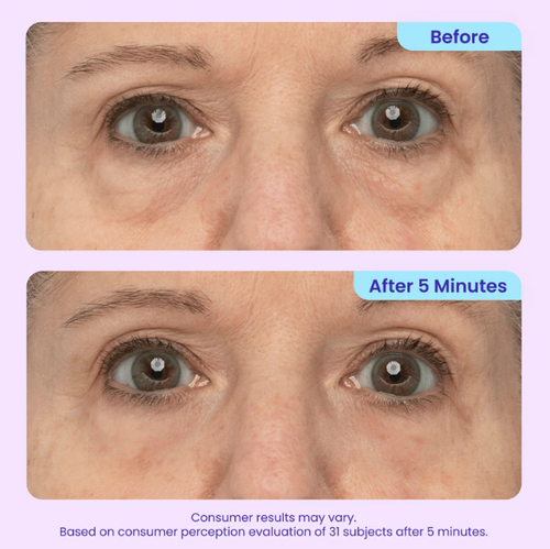 Wellow PureGo™ Instant Eye Lift